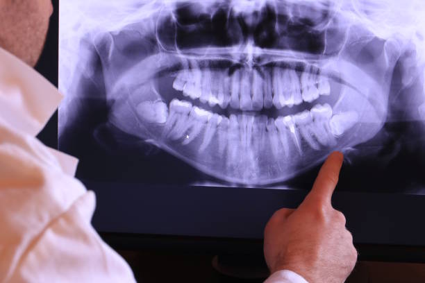 Best Emergency Tooth Extraction in Enlow, PA