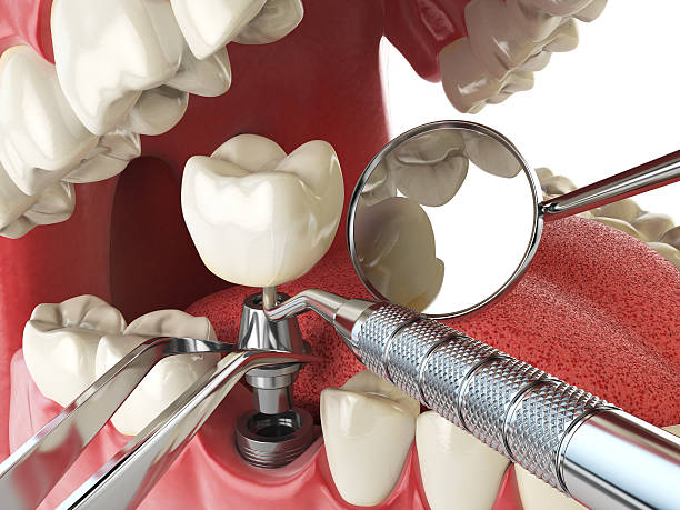 Best Emergency Dental Care for Broken or Chipped Teeth in Enlow, PA
